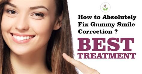 How To Fix Gummy Smile Correction With Best Treatment Care Well