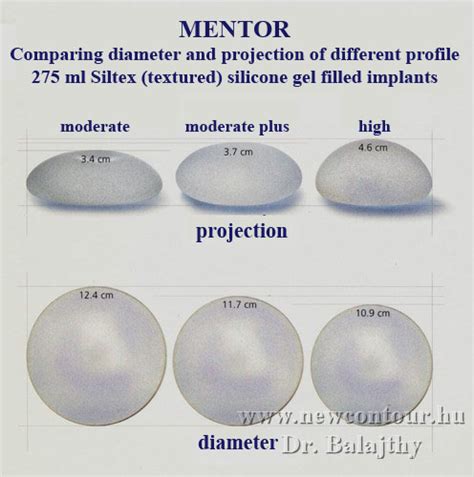 What S Your Implant Size