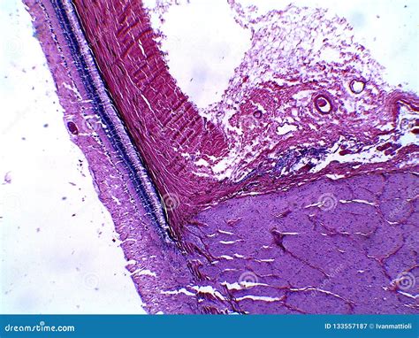 Human Retina and Part of the Blind Spot Under the Microscope Stock ...