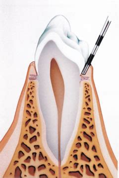 Healthy Gums | How To Prevent Gum Disease