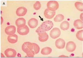 Hematolog A