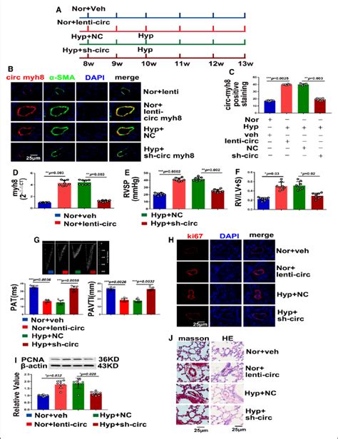 Circ Myh8 Promotes The Development Of Hypoxia Induced Pulmonary