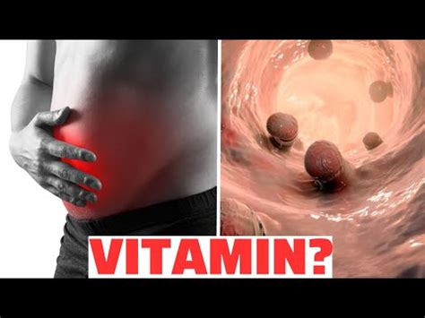 BR 1 VITAMIN za sprečavanje RAKA DEBELOG CRIJEVA YouTube