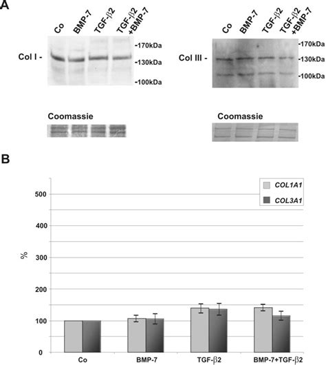 Western Blot For Collagen Types I And Iii Col I And Col Iii A And