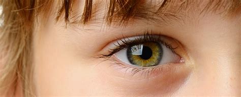 To Diagnose Autism We Should Be Watching The Eyes Sciencealert