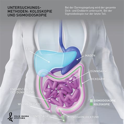 Darmspiegelung Darmkrebs De