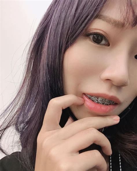 Braces Girls Metal Braces Asian Girl Nose Ring Cute Quick