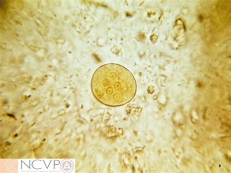 Naegleria Fowleri Cyst