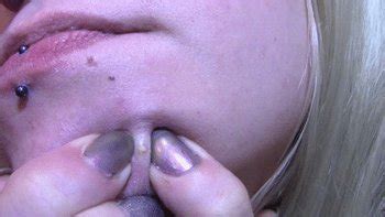 ZIT POPPING Videos And Porn Clips Clips Sale