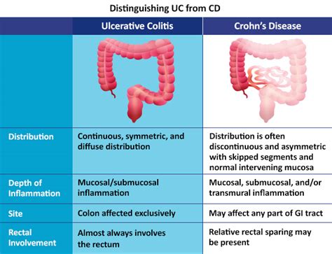 Diagnosis And Comorbidities Ibd Strive