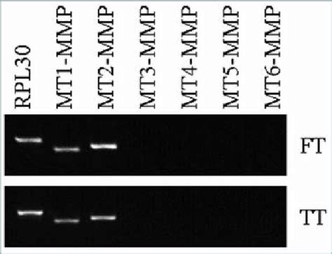 RT PCR Analysis Of MT MMP Expression In Primary Trophoblasts Isolated