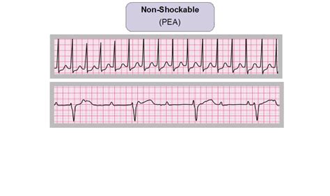 Resuscitation Council (UK) - Advanced Life Support - Using the ALS treatment algorithm