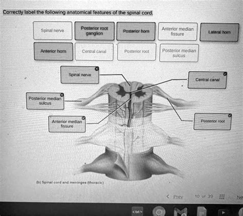 Solved Correctly Label The Following Anatomical Features Of The Spinal