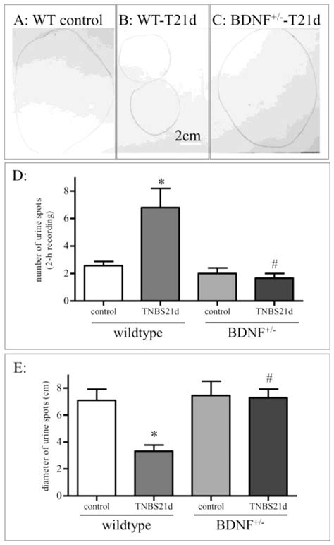 Colitis Induced Bladder Afferent Neuronal Activation Is Regulated By