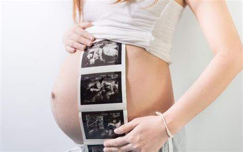 Premium Photo Midsection Of Pregnant Woman Holding Medical X Ray On