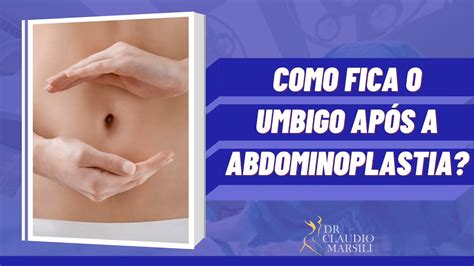Para Que Serve O Umbigo Depois De Grande - Como fica o umbigo após a abdominoplastia? | Dr. Claudio Marsili ...