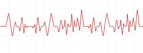 Lijnhartslag Ecg Of Ekg Cardiogram Op Monitor Medische Analyse