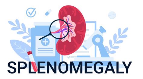 Autoimmune And Inflammatory Causes Of Splenomegaly Diagnosis And