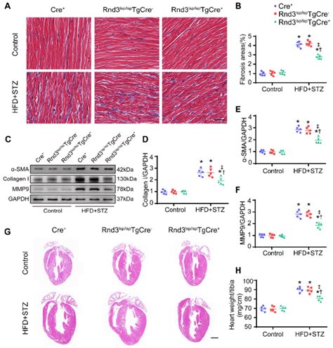 Fibroblast Specific Rnd Overexpression Alleviates Cardiac Fibrosis And