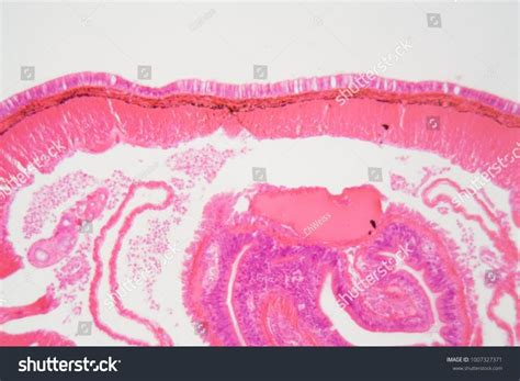 Cross section of an Earthworm under the microscope.section#Cross# ...