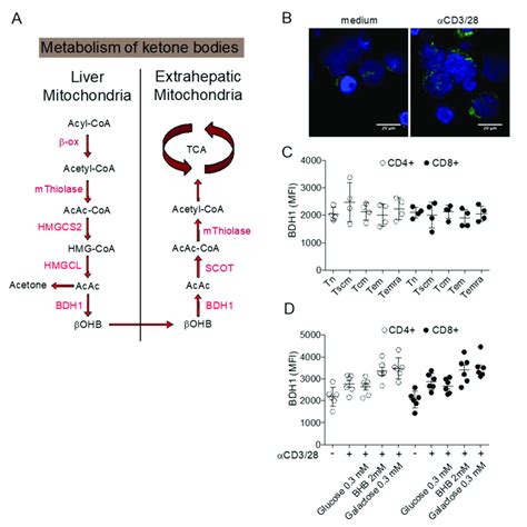 Metabolism of ketone bodies. (A) Schematic representation of ketone ...