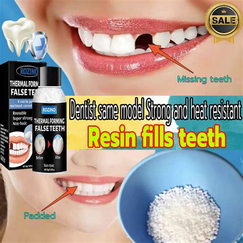 【fast Filling】diy Tooth Repair Kit Temporary Tooth Repair Kit