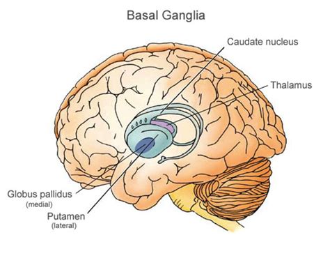 Cerebral Palsy Brain