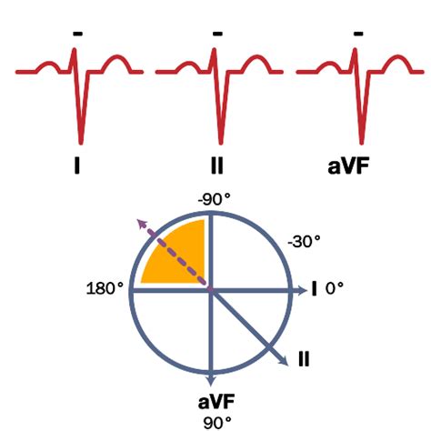 ecg basics visualmed clinical trials