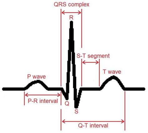 Draw An Ecg Wave Form Representing One Heartbeat Label The Quizlet