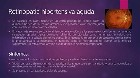 Retinopatía hipertensiva PPT Descarga Gratuita