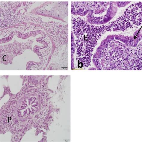 Photomicrograph Of Lung Sections Showing A Bronchiolitis With