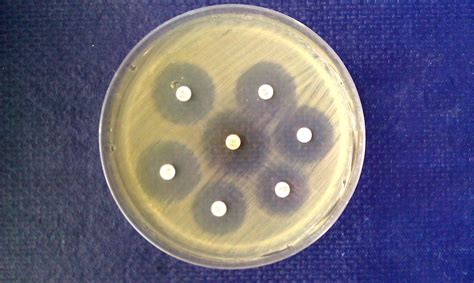 The Kirby Bauer Method And E Test For Antimicrobial Susceptibility Testing Microbiology