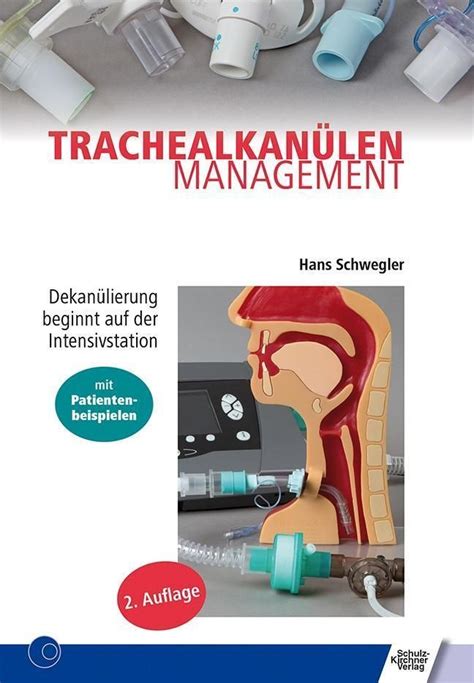 Trachealkanlenmanagement Schwegler Hans Paperback Niemiecki