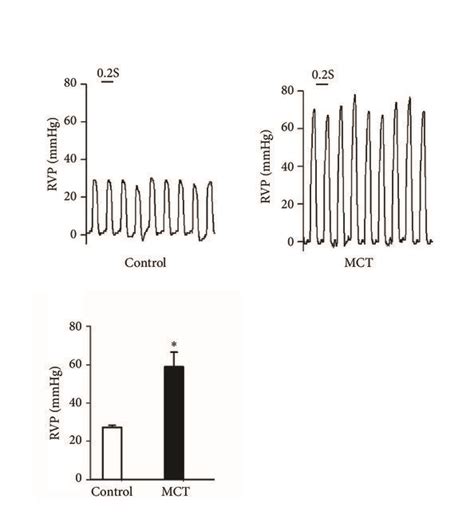 Monocrotaline Mct Induced Pulmonary Arterial Hypertension Pah In