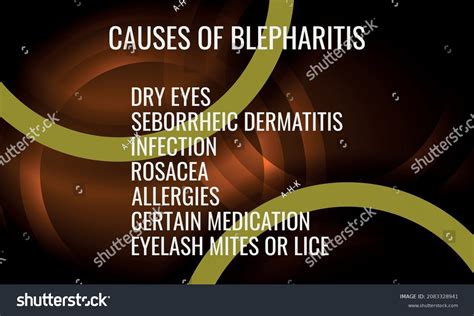 Causes Blepharitis Vector Illustration Medical Journal Stock Vector ...