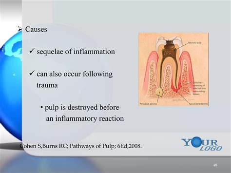 Pulpal & periradicular diseases & their diagnosis | PPTX
