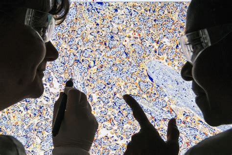 Cracking the mysteries of Alzheimer’s disease - DEMENTIA RESEARCHER