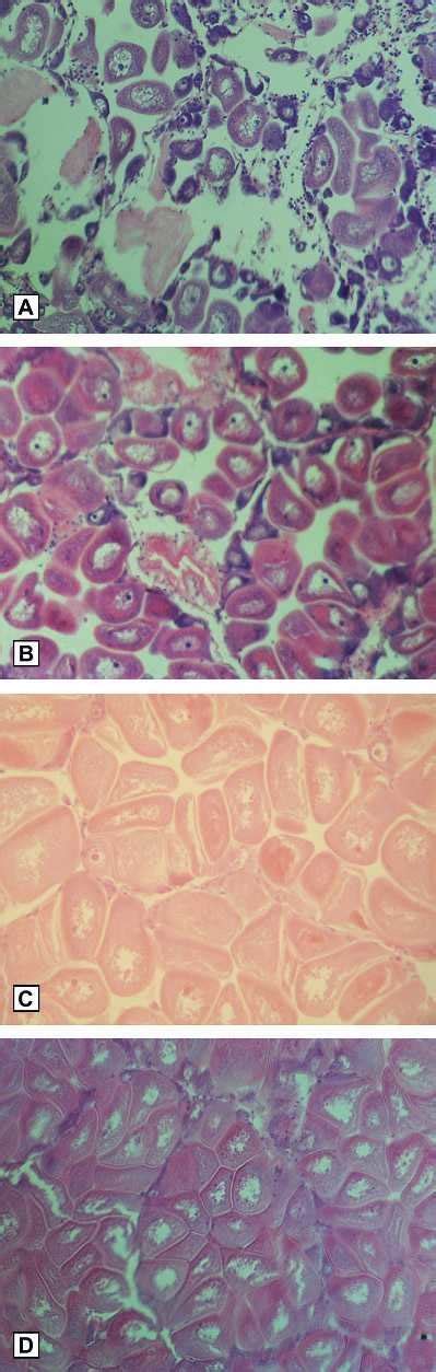 Photomicrographs Of Female Gonadal Stages Of Pecten Sulcicostatus From