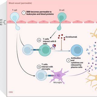 The implication of Ocrelizumab as an anti‐CD20 antibody. In multiple ...