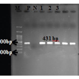 Results of gel electrophoresis related to PCR amplification of various ...