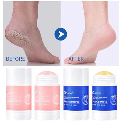 Vaseline Anti Drying Crack Foot Cream Hand Cracked Repair Cream Removal