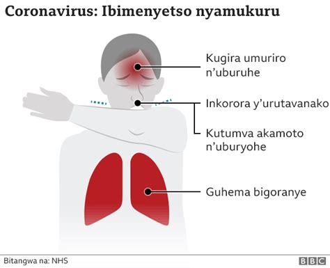 Covid 19 Rwanda Umubare W Abandura Ukomeje Kuzamuka Muri Gereza