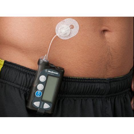 Minimed Paradigm Silhouette Infusion Set