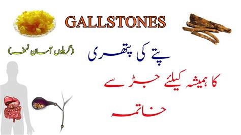 Gallstone Sympotoms Treatment Pity Ki Pathri Ka Desi Ilaj