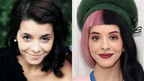 Unlocking The Secrets Of Melanie Martinez S Surgery Discoveries And Insights