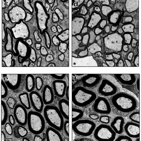 Ultrastructure of myelinated axons at day 23. Transverse sections taken ...