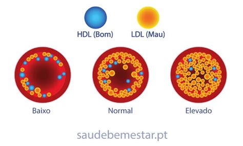 Colesterol O Que Tipos Como Tratar E Prevenir 26550 Hot Sex Picture