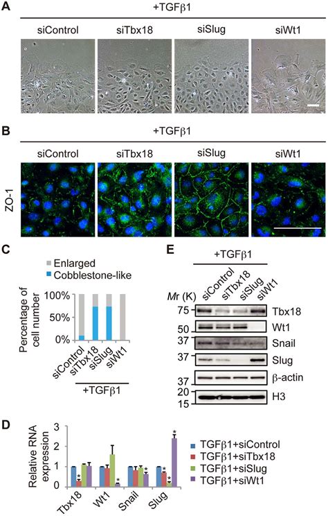 Figure 3 From The Transcription Factors Tbx18 And Wt1 Control The