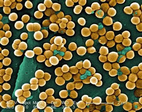 antibiotic treats staph aureus