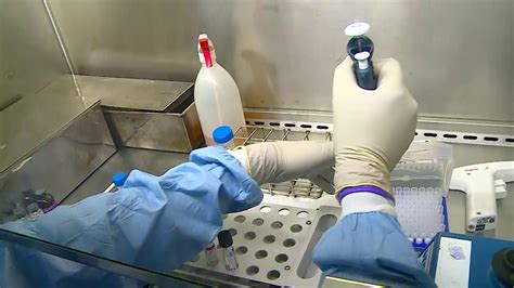 Demonstration Of Drug Susceptibility Testing Of First Line Anti Tb